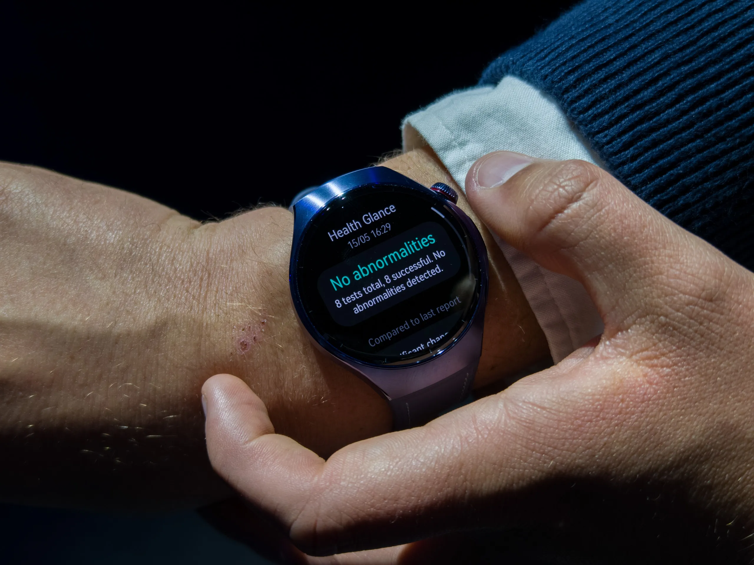 نتائج الفحص الصحي لمدة 60 ثانية على ساعة Huawei Watch 5