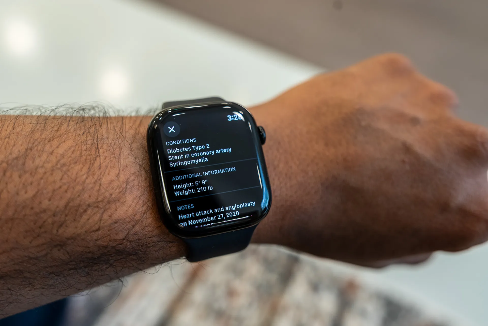 علامات طبية حيوية على Apple Watch Series 10