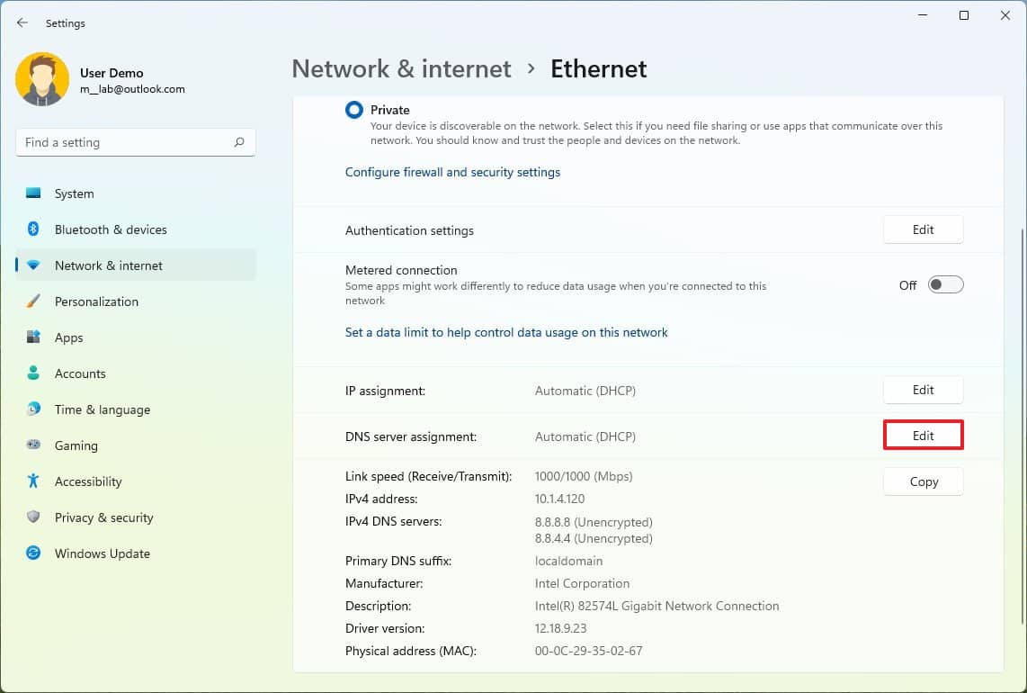 Edit DNS server assignment